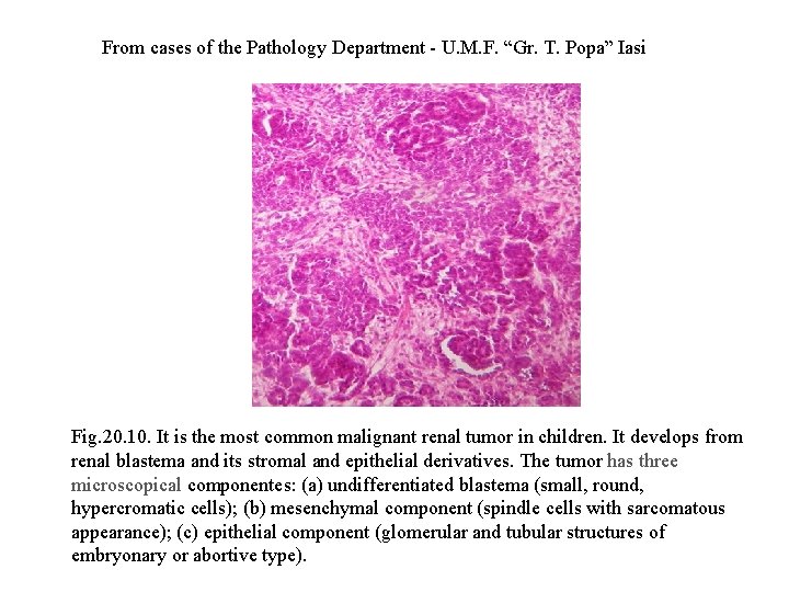 From cases of the Pathology Department - U. M. F. “Gr. T. Popa” Iasi
