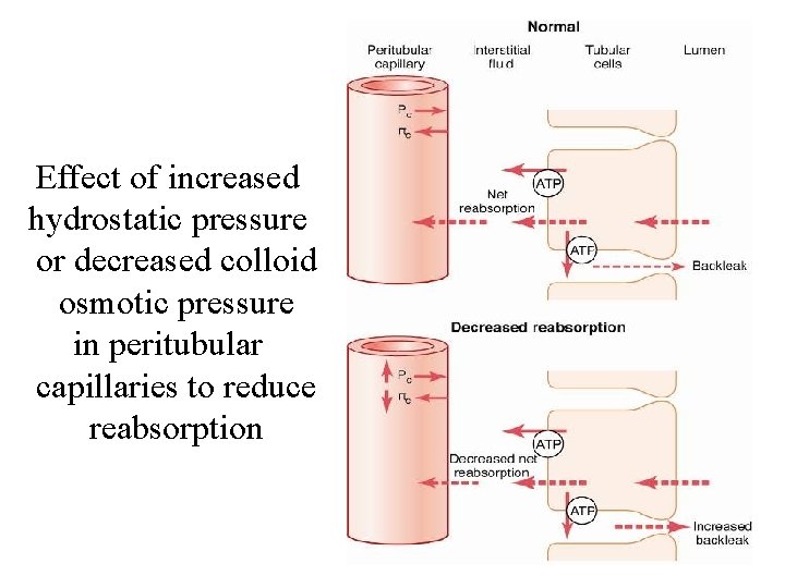 Effect of increased hydrostatic pressure or decreased colloid osmotic pressure in peritubular capillaries to