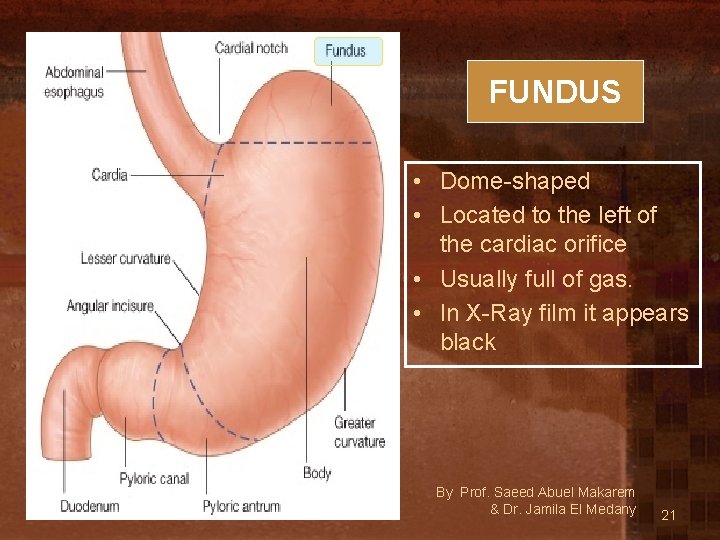 FUNDUS • Dome-shaped • Located to the left of the cardiac orifice • Usually