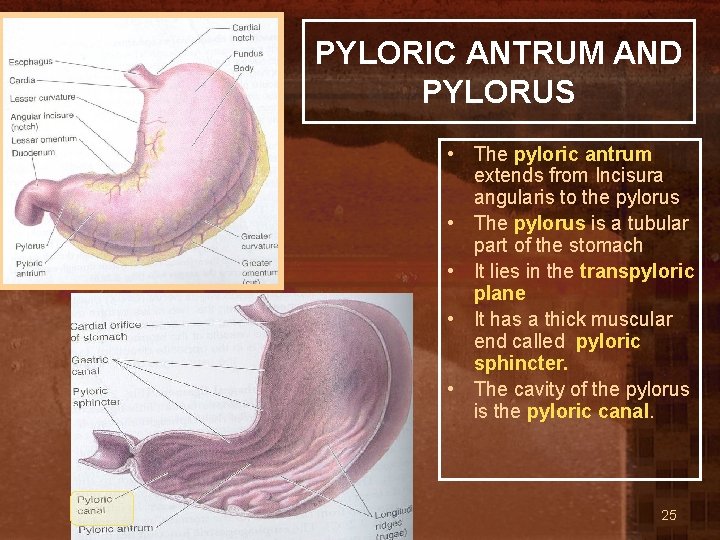 PYLORIC ANTRUM AND PYLORUS • The pyloric antrum extends from Incisura angularis to the