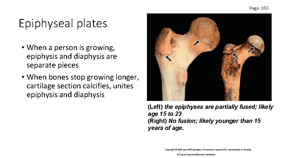 Page 160 Epiphyseal plates • When a person is growing, epiphysis and diaphysis are