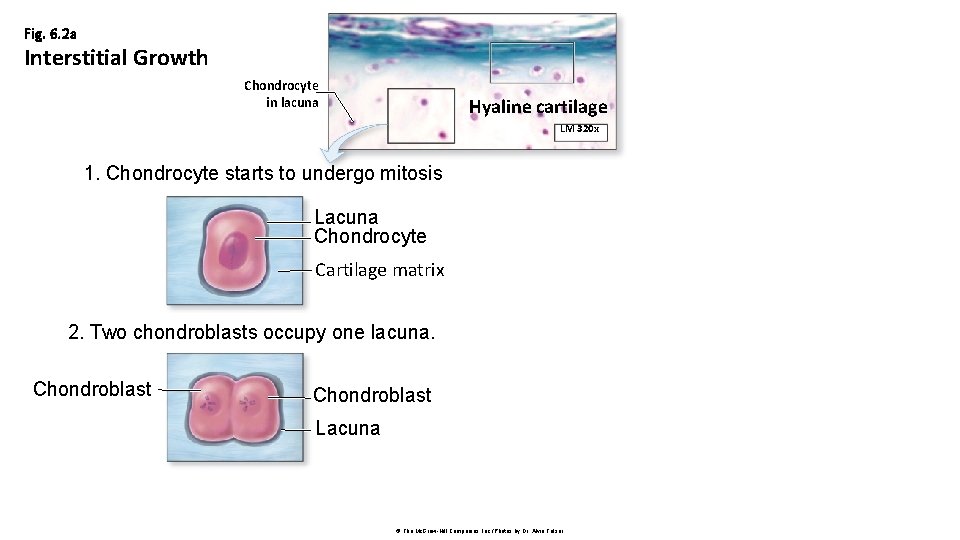 Fig. 6. 2 a Interstitial Growth Chondrocyte in lacuna Hyaline cartilage LM 320 x