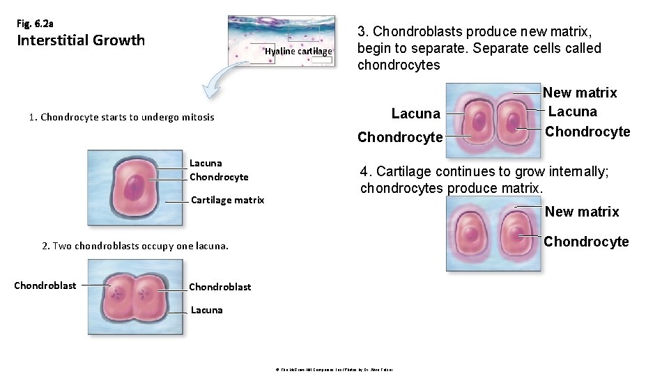 Fig. 6. 2 a Interstitial Growth Hyaline cartilage 1. Chondrocyte starts to undergo mitosis
