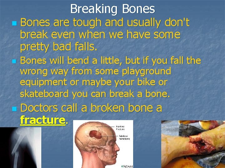 Breaking Bones n n n Bones are tough and usually don't break even when