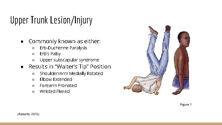 Upper Trunk Lesion/Injury ● Commonly known as either: ○ ○ ○ Erb-Duchenne Paralysis Erb’s