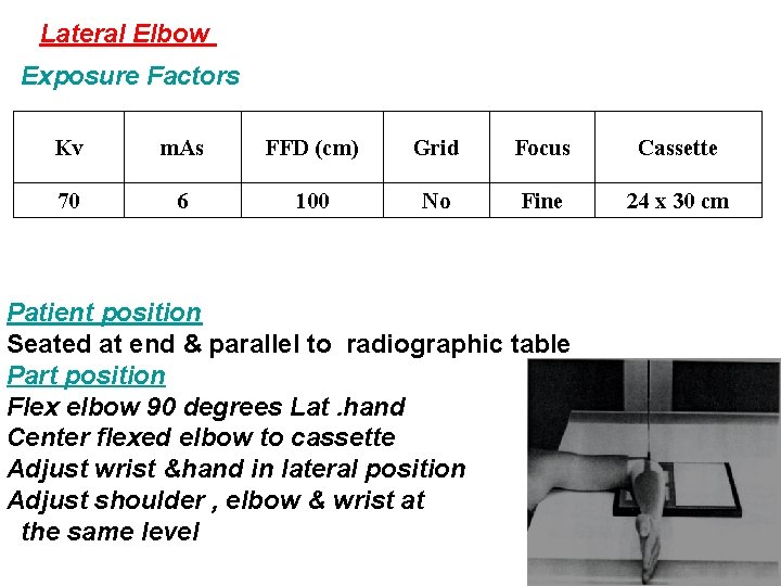 Lateral Elbow Exposure Factors Kv m. As FFD (cm) Grid Focus Cassette 70 6