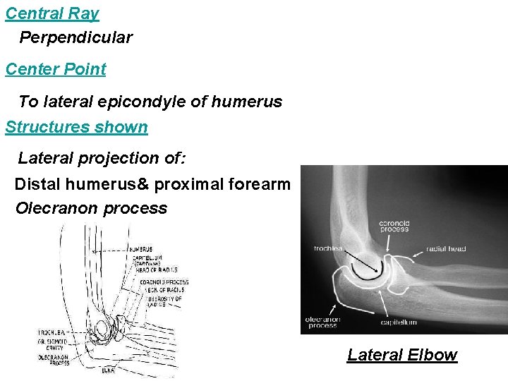 Central Ray Perpendicular Center Point To lateral epicondyle of humerus Structures shown Lateral projection