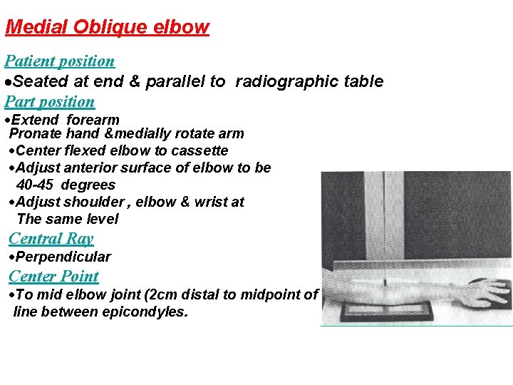 Medial Oblique elbow Patient position Seated at end & parallel to radiographic table Part
