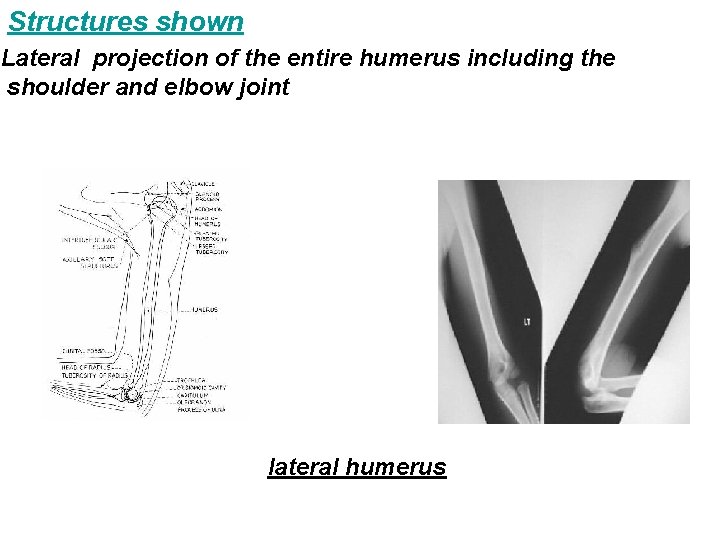 Structures shown Lateral projection of the entire humerus including the shoulder and elbow joint