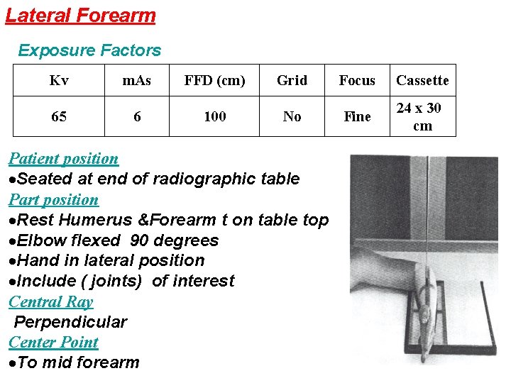 Lateral Forearm Exposure Factors Kv m. As FFD (cm) Grid Focus Cassette 65 6