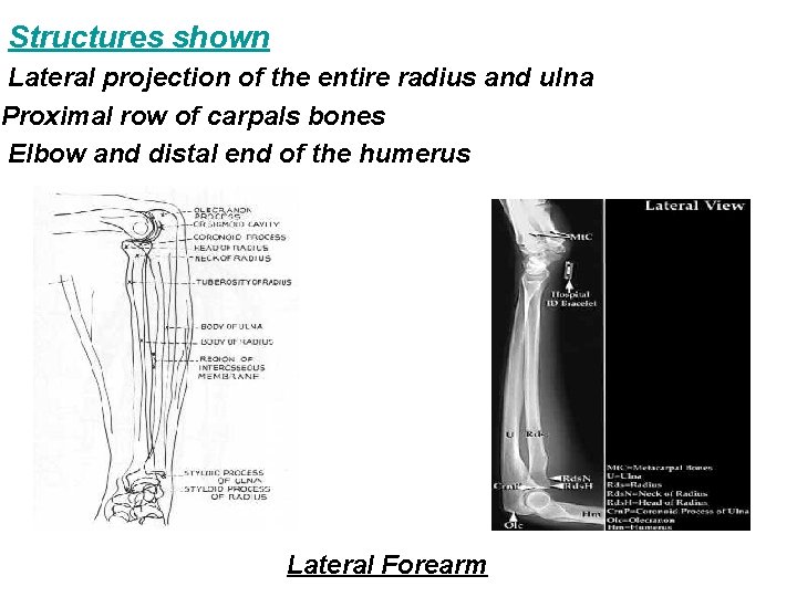 Structures shown Lateral projection of the entire radius and ulna Proximal row of carpals