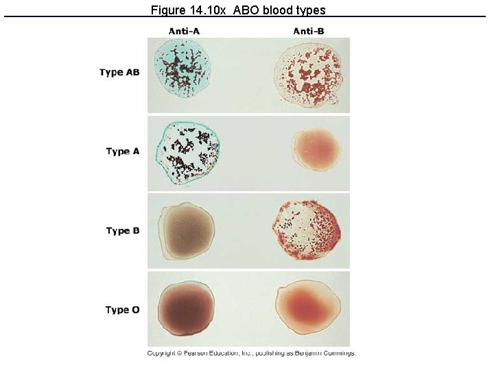 Figure 14. 10 x ABO blood types 