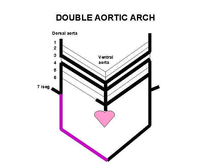 DOUBLE AORTIC ARCH Dorsal aorta 1 2 3 4 5 6 7 iseg Ventral