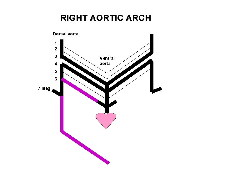 RIGHT AORTIC ARCH Dorsal aorta 1 2 3 4 5 6 7 iseg Ventral