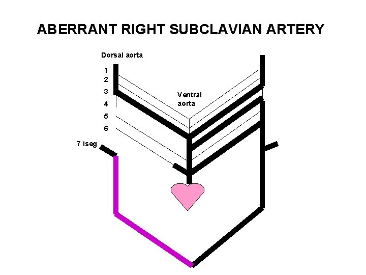 ABERRANT RIGHT SUBCLAVIAN ARTERY Dorsal aorta 1 2 3 4 5 6 7 iseg