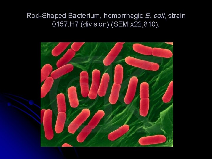 Rod-Shaped Bacterium, hemorrhagic E. coli, strain 0157: H 7 (division) (SEM x 22, 810).