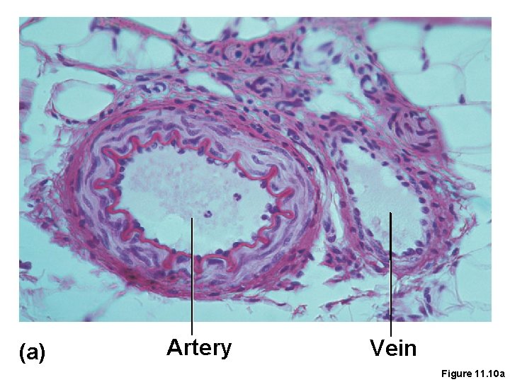 (a) Artery Vein Figure 11. 10 a 