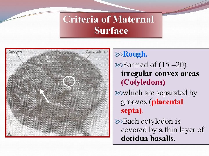 Criteria of Maternal Surface Rough. Formed of (15 – 20) irregular convex areas (Cotyledons)