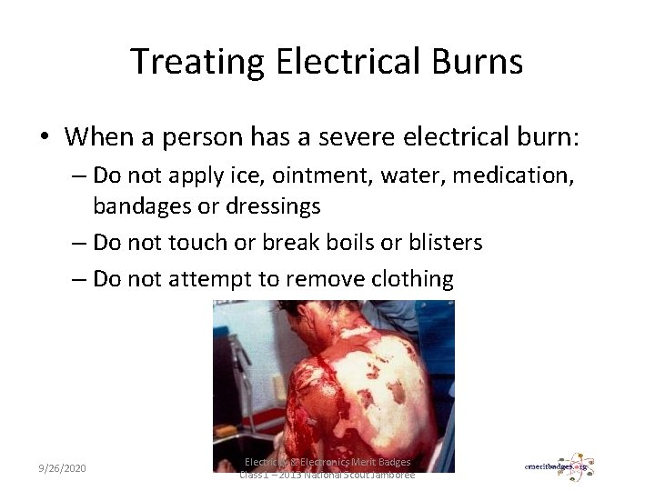 Treating Electrical Burns • When a person has a severe electrical burn: – Do