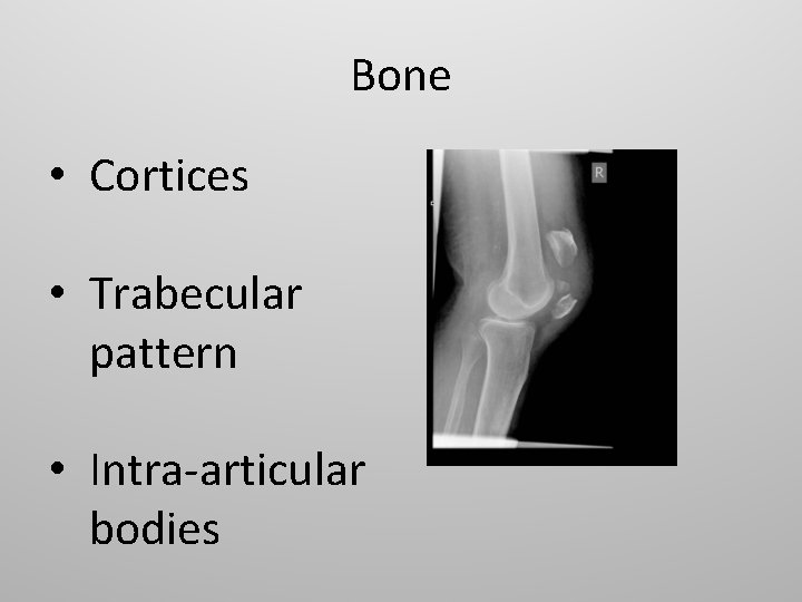 Bone • Cortices • Trabecular pattern • Intra-articular bodies 