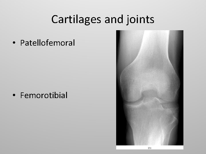 Cartilages and joints • Patellofemoral • Femorotibial 