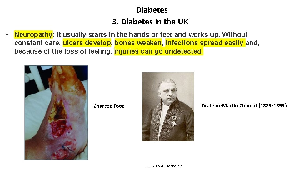 Diabetes 3. Diabetes in the UK • Neuropathy: It usually starts in the hands