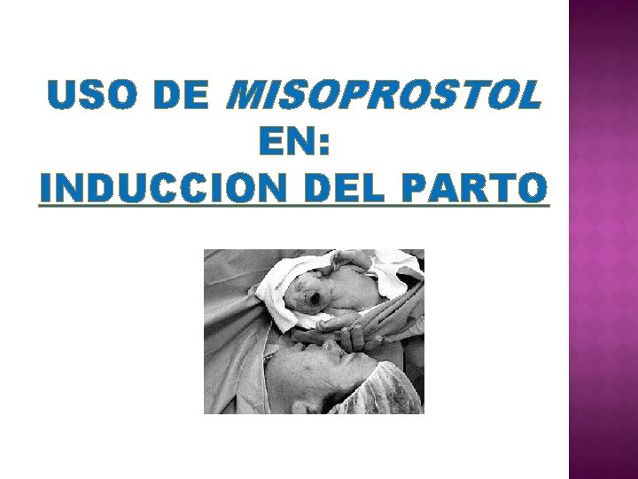 USO DE MISOPROSTOL EN: INDUCCION DEL PARTO 