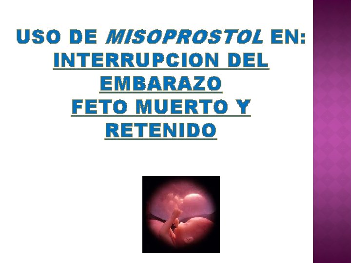 USO DE MISOPROSTOL EN: INTERRUPCION DEL EMBARAZO FETO MUERTO Y RETENIDO 