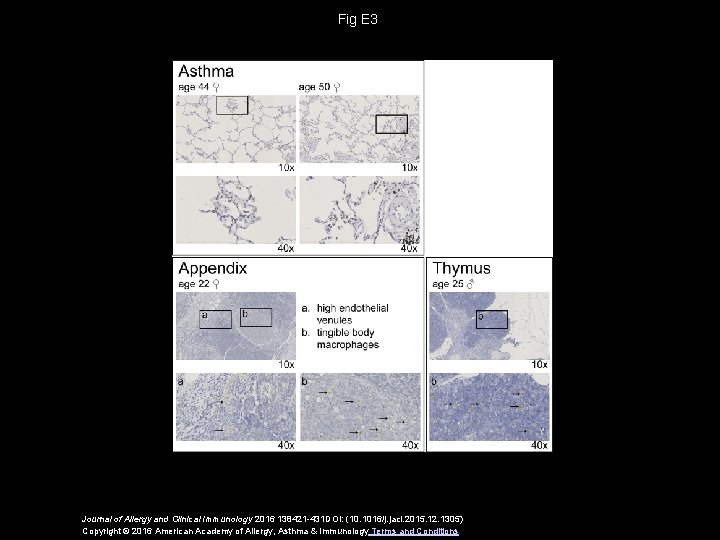 Fig E 3 Journal of Allergy and Clinical Immunology 2016 138421 -431 DOI: (10.