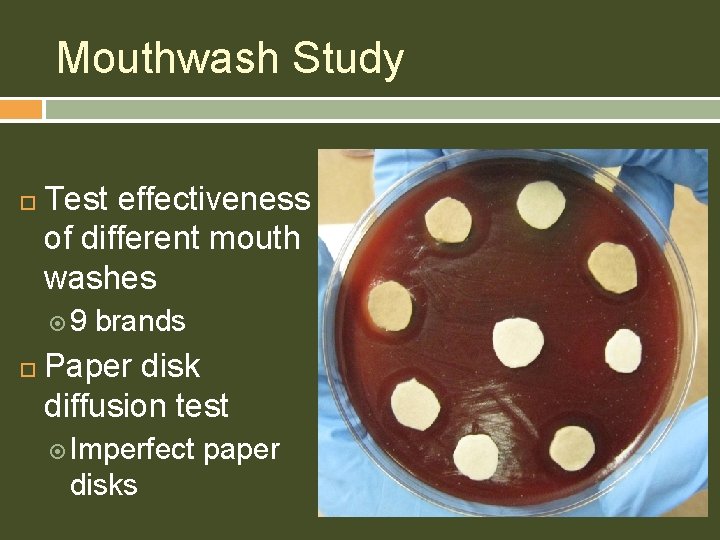 Mouthwash Study Test effectiveness of different mouth washes 9 brands Paper disk diffusion test