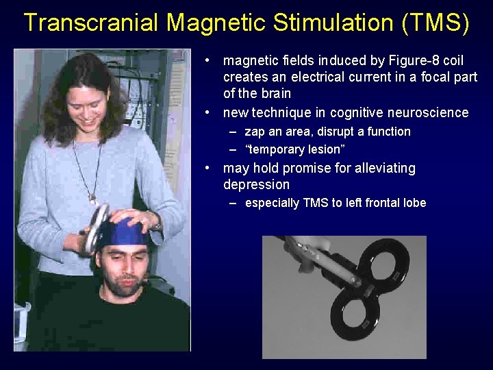 Transcranial Magnetic Stimulation (TMS) • magnetic fields induced by Figure-8 coil creates an electrical