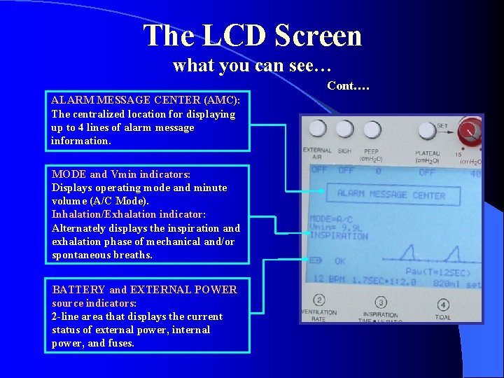 The LCD Screen what you can see… Cont…. ALARM MESSAGE CENTER (AMC): The centralized