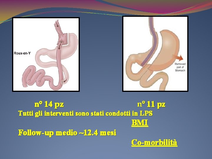 n° 14 pz n° 11 pz Tutti gli interventi sono stati condotti in LPS