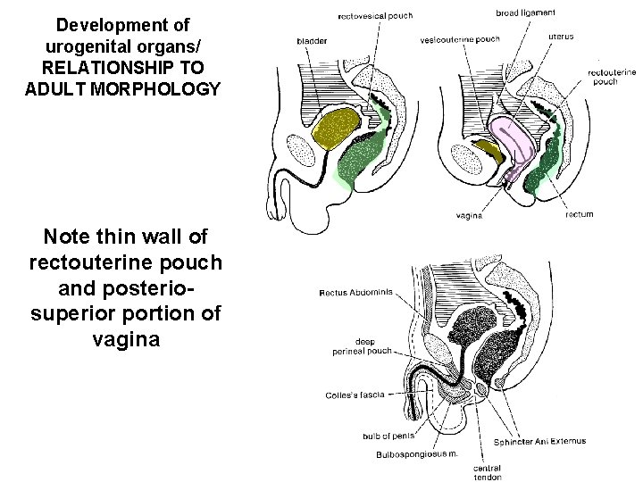 Development of urogenital organs/ RELATIONSHIP TO ADULT MORPHOLOGY Note thin wall of rectouterine pouch