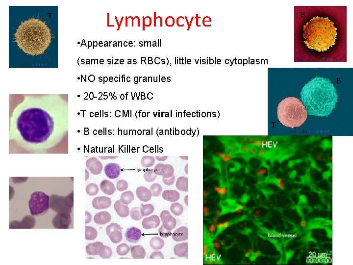 T Lymphocyte B • Appearance: small (same size as RBCs), little visible cytoplasm •