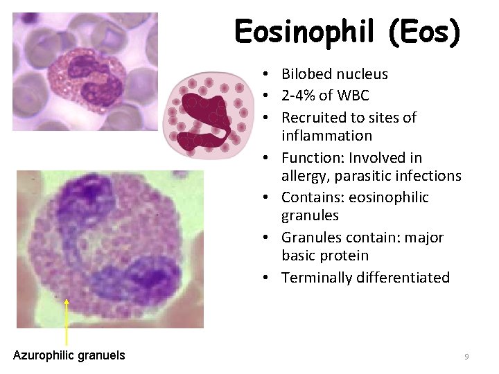 Eosinophil (Eos) • Bilobed nucleus • 2 -4% of WBC • Recruited to sites