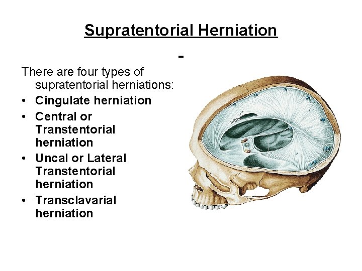 Supratentorial Herniation There are four types of supratentorial herniations: • Cingulate herniation • Central