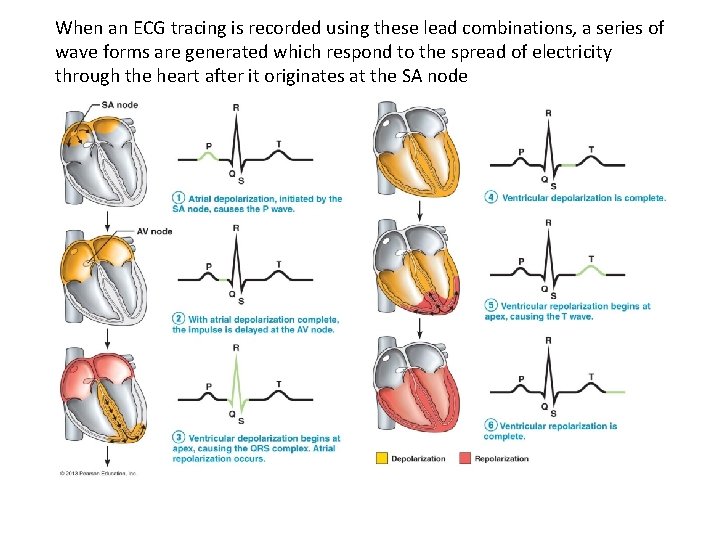 When an ECG tracing is recorded using these lead combinations, a series of wave