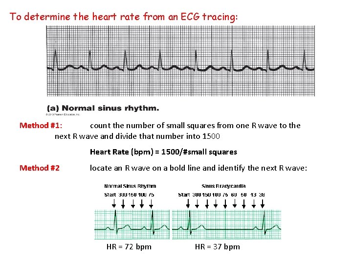 To determine the heart rate from an ECG tracing: Method #1: count the number