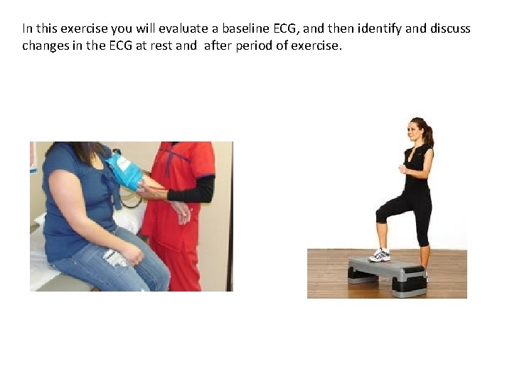 In this exercise you will evaluate a baseline ECG, and then identify and discuss