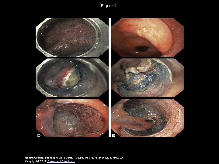 Figure 1 Gastrointestinal Endoscopy 2019 90467 -479. e 4 DOI: (10. 1016/j. gie. 2019.