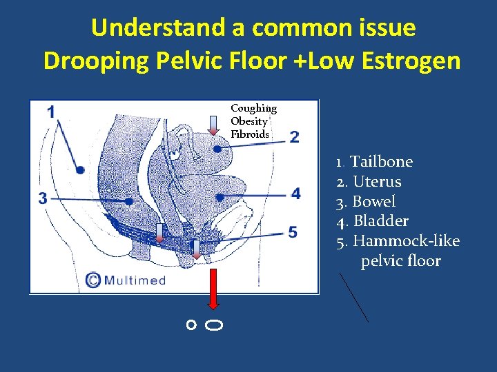 Understand a common issue Drooping Pelvic Floor +Low Estrogen Coughing Obesity Fibroids 1. Tailbone