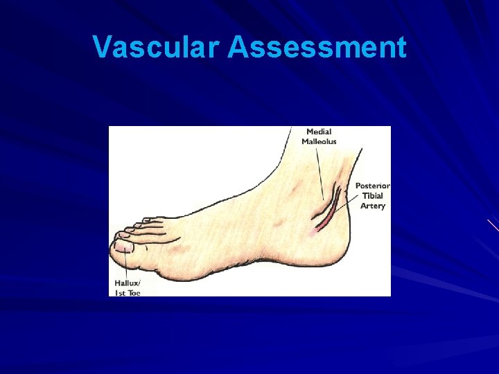 Vascular Assessment 