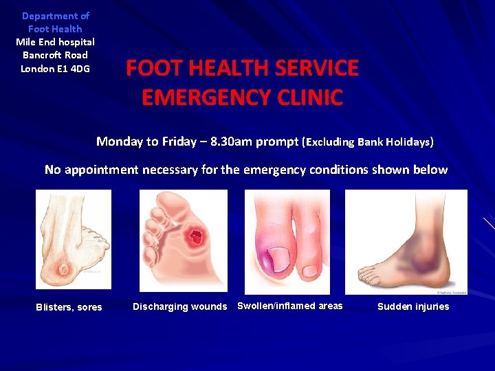 Department of Foot Health Mile End hospital Bancroft Road London E 1 4 DG