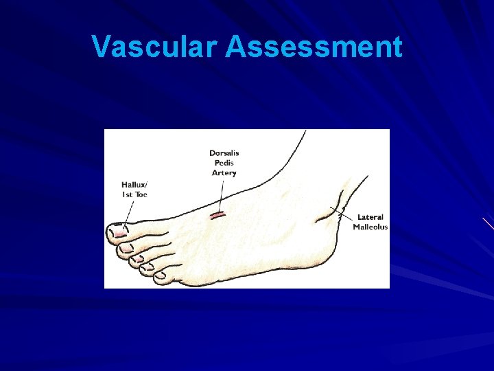 Vascular Assessment 