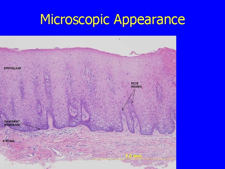 Microscopic Appearance 
