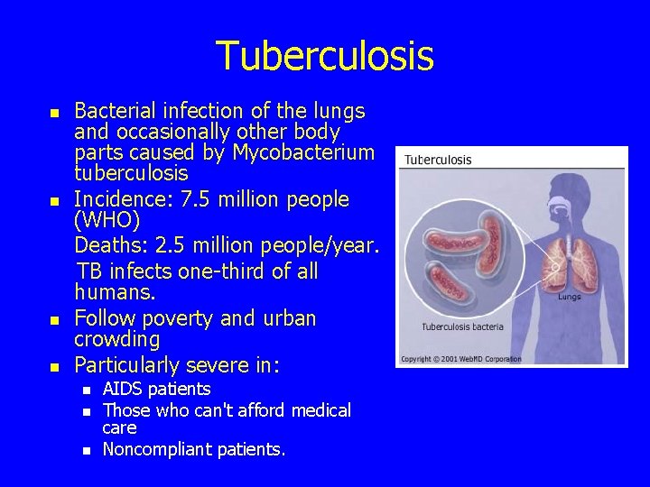 Tuberculosis n n Bacterial infection of the lungs and occasionally other body parts caused