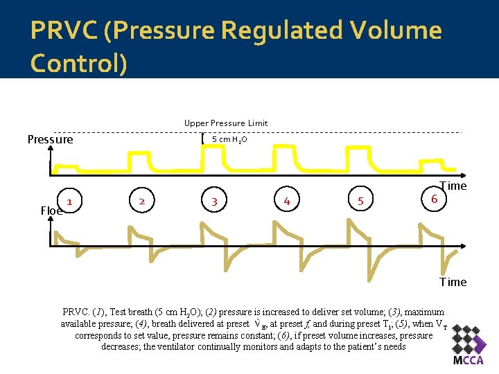 PRVC (Pressure Regulated Volume Control) Upper Pressure Limit Pressure Floe 1 5 cm H