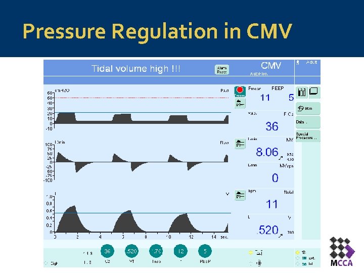 Pressure Regulation in CMV 