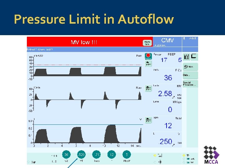 Pressure Limit in Autoflow 